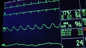 transplante de rins aplicativo
