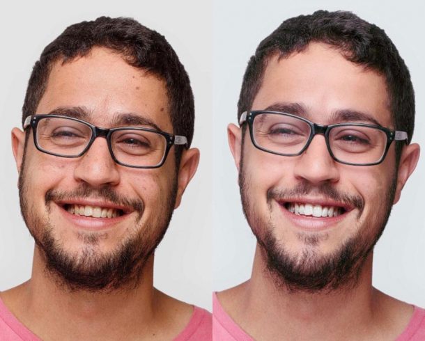 aplicativos-clarear-dentes-android-facetune